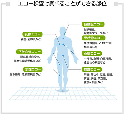 超音波検査01