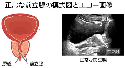 超音波検査14